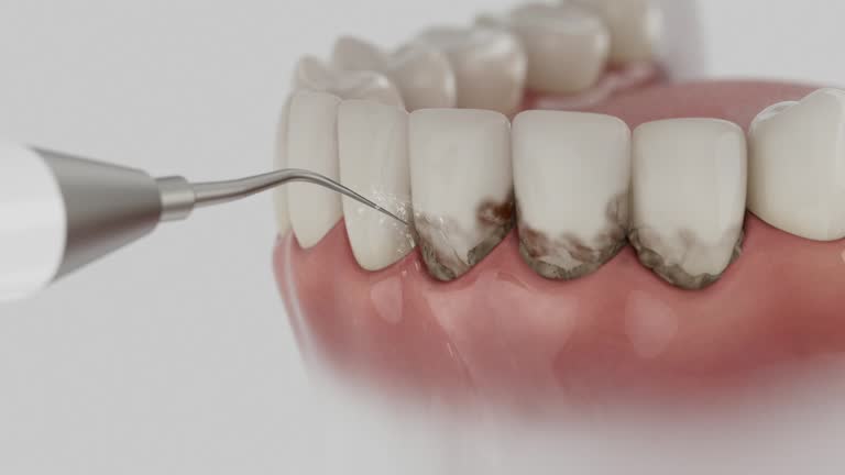 Reliable Dental Implants contractor in Luling, LA by Smile Center Dentistry